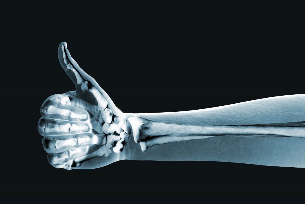Cannabidiol: Osteoporosis Bone Health